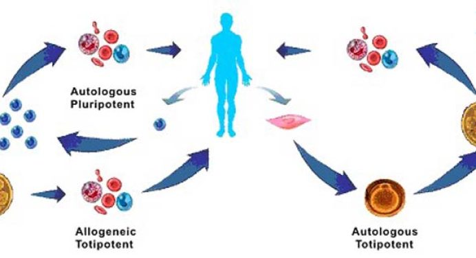 Allogeneic Stem Cells & Allogeneic cell transplantation