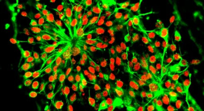 Gastrulation Germ Layer definition and formation in humans