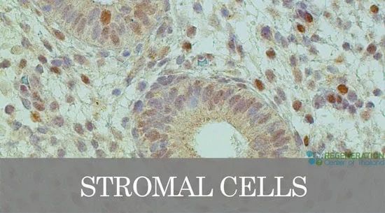 stromal-stem-cells