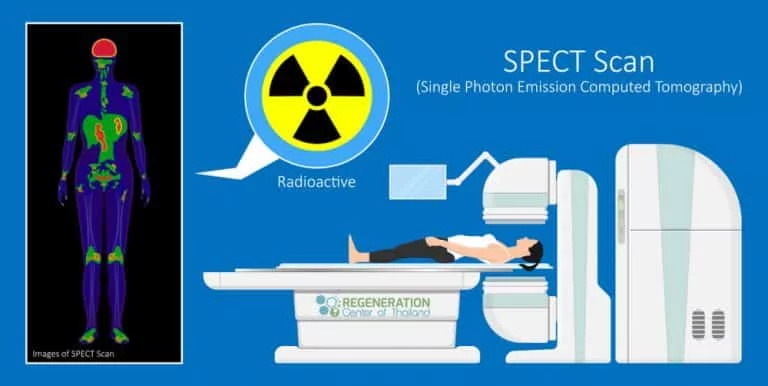 cancer treatment in thailand