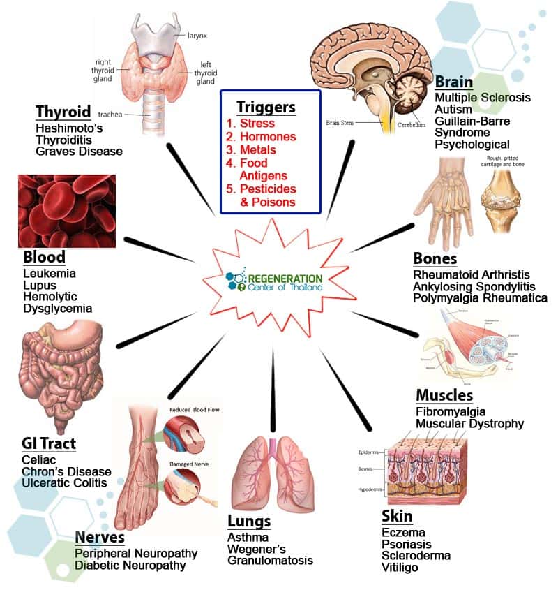 Types-Autoimmune-Disease-Treatment-Stem-Cells