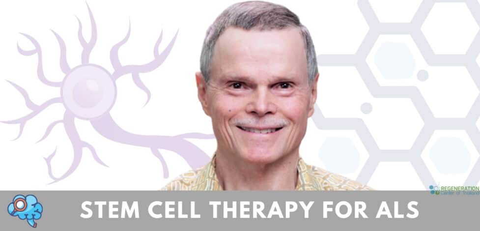 stemcell treatment ALS neural cells