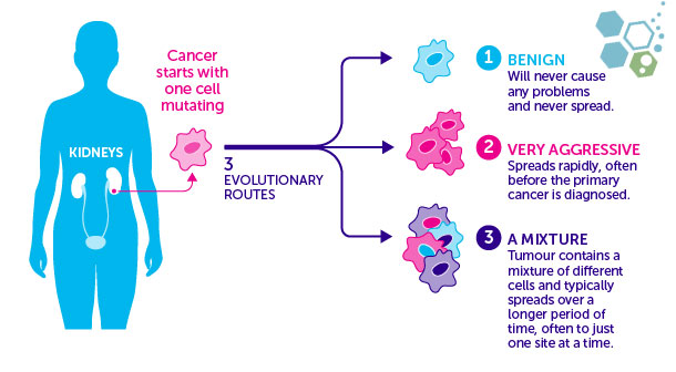 spread-of-kidney-cancer-stemcells