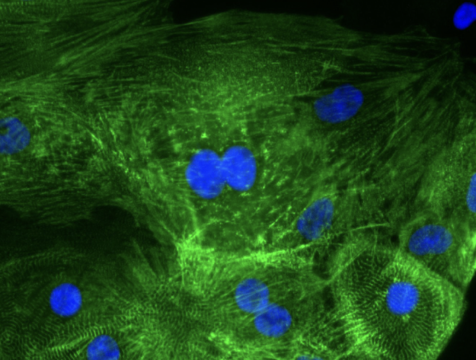 heart stem cells