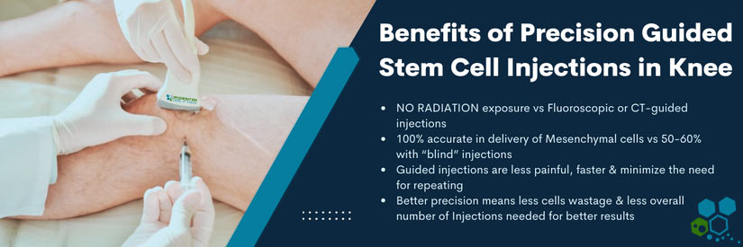 Ultrasound-guided-stem-cell-injections-knee