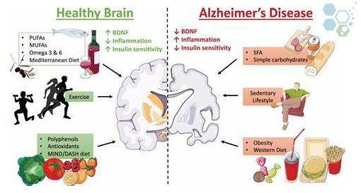 healthy-brain-super-food-diet