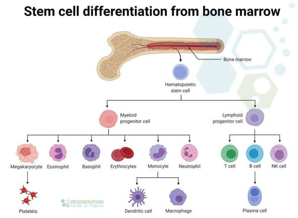 Bone-marrow-transplant-procedure