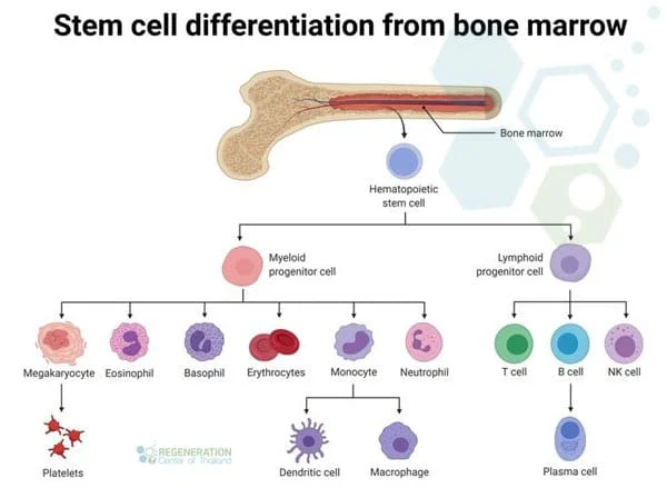 Bone-marrow-transplant-procedure