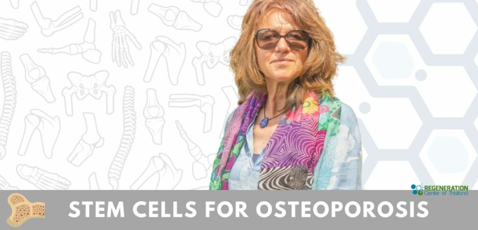 Stem Cell Treatment for Osteoporosis bone fractures
