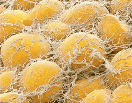 Brown Fat Stem Cells