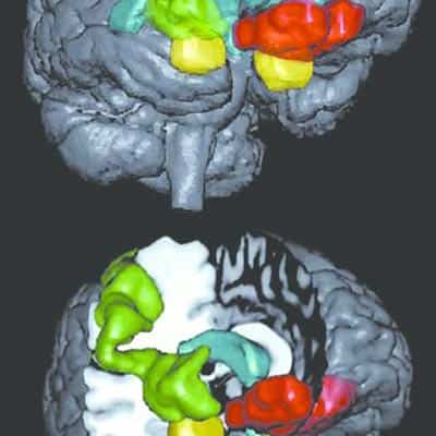 Neuroanatomy-Regeneration-Apashia