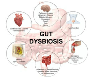 stemcells-metabolic-diseases-gastrointestinal-disorders
