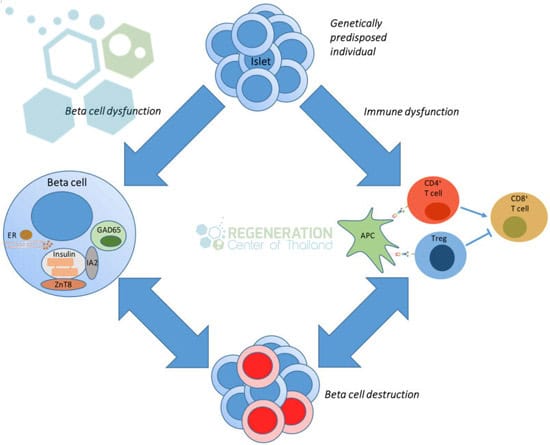 stemcells-type-1-diabetes-reversal