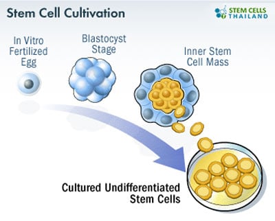 stem-cell-expansion-stemcellhospital