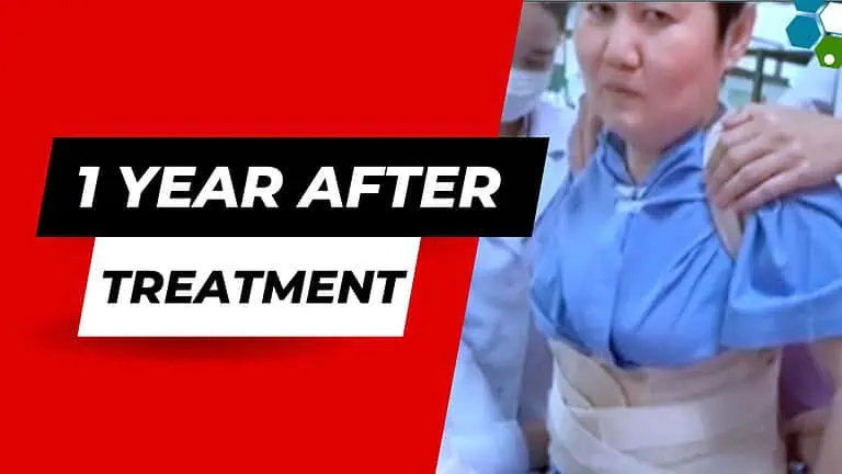 1_Year_After_stem-cell-spine-Treatment